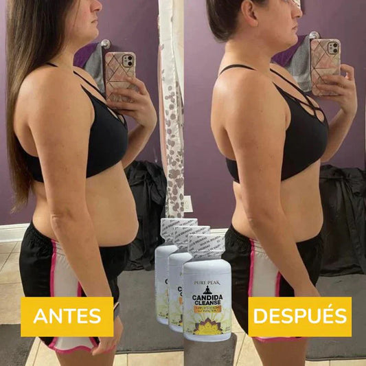 El Original: Candida Cleanse